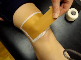 Image result for Patellar Tilt Test