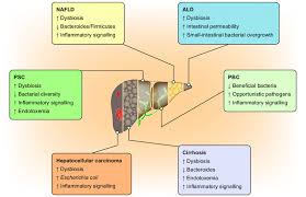 The Role Of Intestinal Microbiota In Liver Disease Ald Download Scientific Diagram