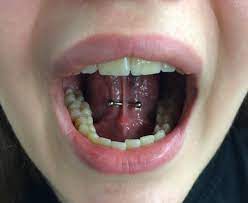Tongue Web By Kirst Devilsowntattoos Leicester Piercing Tongue