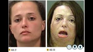 If the initial term of an arithmetic progression. The Shocking Faces Of Meth Campaign Youtube