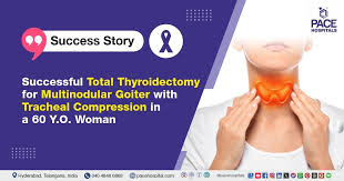 Image result for Multinodular Goiter