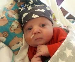 Our Son Had Noonan Syndrome