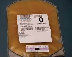 Image result for Platelet Transfusion