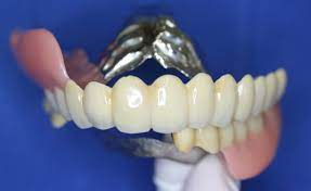 40代・50代の人におすすめの、目立たない入れ歯はありますか？ - 神奈川県茅ヶ崎、藤沢、平塚市の入れ歯なら岩田歯科医院へ