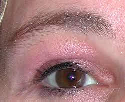 You can also make your eyebrows grow out using rogaine, hair powders, serums and conditioners. Prp Platelet Rich Plasma Injections For Eyebrow Hair Regrowth Explore Plastic Surgery