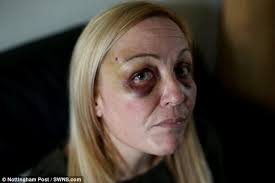 Nottingham mother beaten in random attack 'forced to wait 2 DAYS before  police interview'