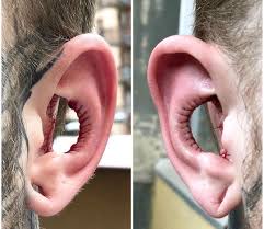 Homem Arranca Auricula Da Orelha Em Nova Modificacao Bizarra Fotos R7 Hora 7 O daith é um piercing muito feminino e delicado, mas também é muito descolado. homem arranca auricula da orelha em