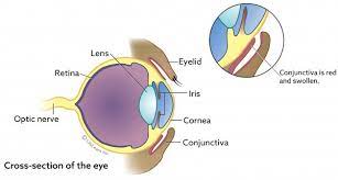 Sudden Acquired Retinal Degeneration Syndrome Sards Vca Animal Hospital