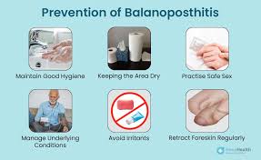 Image result for balanoposthitis