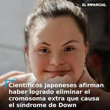 En un descubrimiento que podría transformar el tratamiento del síndrome de  Down, un equipo de científicos de la Universidad de Salud de Fujita y la  Universidad de Medicina de Mie, en Japón,