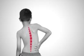 Sakit punggung disebabkan adanya masalah yang memengaruhi otot, tulang, atau saraf di punggung. Jangan Sepelekan Pundak Yang Tinggi Sebelah Bisa Jadi Tanda Skoliosis Atau Kelainan Tulang Belakang Semua Halaman Grid Health
