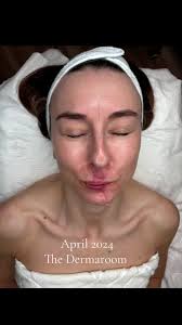 Accident at Chloorkop 05 April 2024