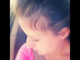 Avoid wearing tight hats for fashion. Taming Your Baby Hairs Regrowth Youtube