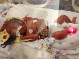 Photoshop trolling is always a great way to waste my time :|. Photoshop Request My Son Passed Away A Few Years Ago After Two Short Weeks In The Hospital And I Have No Pictures Of Him Without All Of The Tubes I Saw A