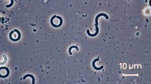Maybe you would like to learn more about one of these? Spirilla Bacteria Seen Through A Compound Microscope Youtube
