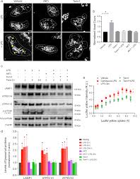 Can a cell survive without lysosomes. Enhanced Translation Expands The Endo Lysosome Size And Promotes Antigen Presentation During Phagocyte Activation