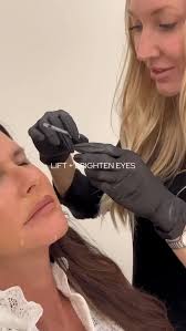 Enhancing features with neurotoxins instead of freezing faces🤍, Blur  lines, Open eyes, Lift brows, Relax chin, Sharpen jawline