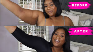 Women Post Surgery Arm Shaper Slimming Weight Loss Sleeves Humpback  Shapewear | Ebay