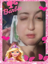 Dental surgery has me