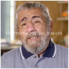 Dermatoloq Uzman Dr Mehdi İskəndərli