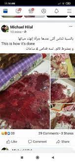 هل قطع شرايين اليد اليسري يؤدي الي الموت. Ø¨Ø¹Ø¯ Ù‚Ø·Ø¹ Ø´Ø±Ø§ÙŠÙŠÙ† ÙŠØ¯Ù‡ ÙˆØªØ¯Ø§ÙˆÙ„ ØµÙˆØ±Ù‡ Ø¹Ù„Ù‰ ÙÙŠØ³Ø¨ÙˆÙƒ Ø§Ù„Ø·Ø¨ÙŠØ¨ Ø§Ù„Ù…Ù†ØªØ­Ø± ÙŠØ¹ÙˆØ¯ Ù„Ù„Ø­ÙŠØ§Ø© ØµÙˆØ± Ø¨ÙˆØ§Ø¨Ø© Ø§Ù„Ø£Ù‡Ø±Ø§Ù…