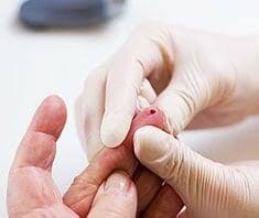 Neuer Allergietest Chip Hilft Bei Diagnose Von Allergien Gesund Co At