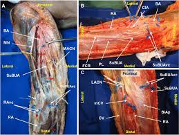 The kidneys and spleen are also shown with their respective arteries. Right Upper Limb Dissection Photographs Showing The Origin And Path Of Download Scientific Diagram
