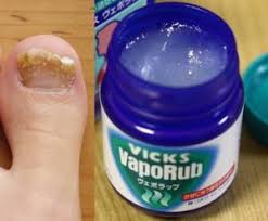 vapor rub for toenail fungus treatment