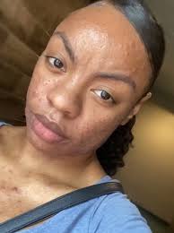 Transforming my skincare journey with Susenji Luna