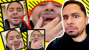 Genealogy for larry hernandez (deceased) family tree on geni, with over 200 million profiles of ancestors and living relatives. Larry Hernandez A 3 Anos Del Accidente Muestra El Terrible Dano En Sus Dientes
