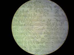 Premature Rupture Of Membranes And P Prom Teachmeobgyn