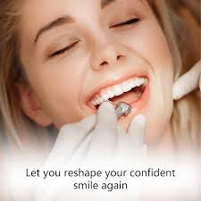 84Pcs False Teeth, Fake Teeth Dental Acrylic Resin Denture, Denture Repair  Kit, 23 Shade A2 Upper + Lower Dental Materials for Replacement, for  Missing Loose Tooth, 3 Sets, 23 A2 : Amazon.co.uk: