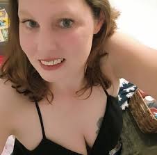 Hi all, I just wanted to ask does anyone else suffer badly with face flear  ups like this at all? I've been having these for years now, we first  thought it was