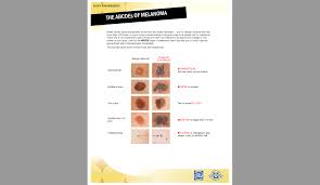 Painless, firm, shiny lumps on the skin. Abcde The Skin Cancer Symptoms You Need To Know
