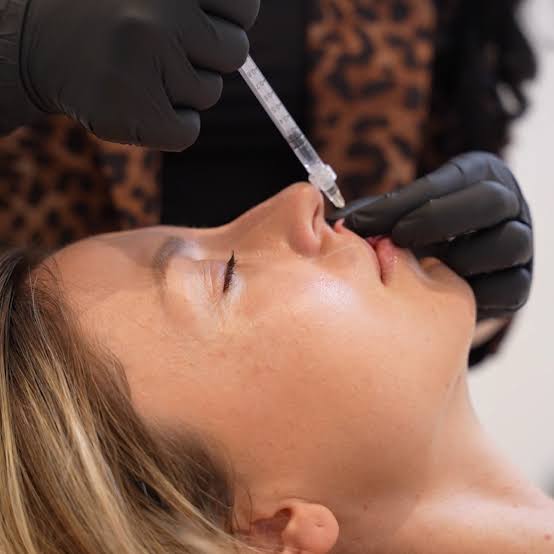 Lip Fillers Dubai | Lip Filler Injections | Lip Augmentation | Biolite