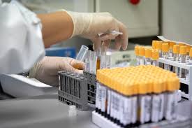 Pazienti positivi al coronavirus dimessi senza essere stati sottoposti al tampone. Salgono A 130 I Positivi Da Francescon A Rodigo Gia Dimessi Due Dei Tre Ricoverati Tutti Negativi I Tamponi In Un Azienda Agricola Di Sermide Mantovauno It