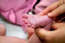 Image result for Babinski Reflex