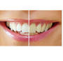 Smirk to Smile Teeth Whitening from smirktosmile.com