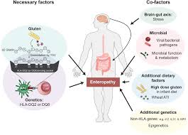 1 department of medical and surgical sciences and advanced technologies gf ingrassia, ent section, university of catania, catania, italy. Co Factors Microbes And Immunogenetics In Celiac Disease To Guide Novel Approaches For Diagnosis And Treatment Gastroenterology