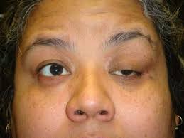 Grand Rounds February 26, 2009 Allison Rand, M.D.