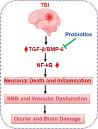„brutali trauma, bet aš ją įveiksiu. Rebuilding Microbiome For Mitigating Traumatic Brain Injury Importance Of Restructuring The Gut Microbiome Brain Axis Springerlink