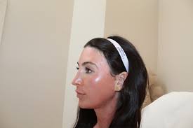 Microneedling, Contour Collection — Denv.Her.