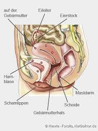 Die leber ist das größte entgiftungsorgan des menschlichen körpers. Endometriose Beschreibung Symptome Folgen Behandlung Netdoktor