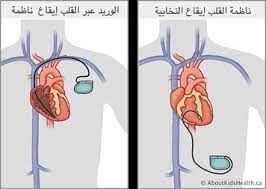 وطبيب ألماني يكشف كواليس اللحظات الأولى بعد سقوط إريكسن على أرض الملعب. Ø¬Ù‡Ø§Ø² ØªÙ†Ø¸ÙŠÙ… Ø¶Ø±Ø¨Ø§Øª Ø§Ù„Ù‚Ù„Ø¨ Ø±Ø¹Ø§ÙŠØ© Ø·ÙÙ„Ùƒ ÙÙŠ Ø§Ù„Ù…Ù†Ø²Ù„