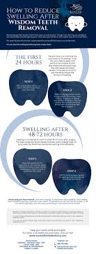 You'll likely have swelling and mild discomfort for 3 or so days. Swelling After Wisdom Teeth Removal Teethwalls