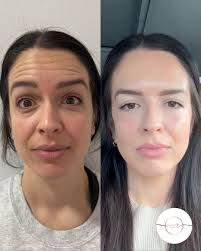 🌟 Join us in welcoming Meghan Bates, PA-C! Originally from Charlotte, NC,  Meghan earned her degree from Clemson and completed her PA training at  Weill Cornell in NYC. She began her career