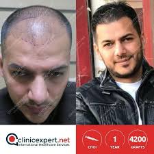 Clinicexpert Photos Facebook