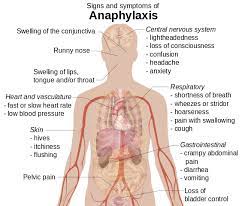 Unfortunately, over 80% of all. How Long Do Hives Last After An Allergic Reaction
