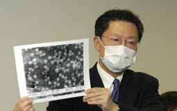 荃灣綠楊新村 r 座出現小型爆發，7 個單位先後有 12 人確診，港大微生物學系講座教授袁國勇連同衛生防護中心、環保署、屋宇署等中午到. æ¸¯å¤§ç¢ºèªéžå…¸åž‹è‚ºç‚Žç‚ºå† ç—…æ¯'è‚ºç‚Ž