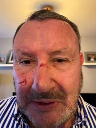 Pet owner says intervening in dog attack in Minster